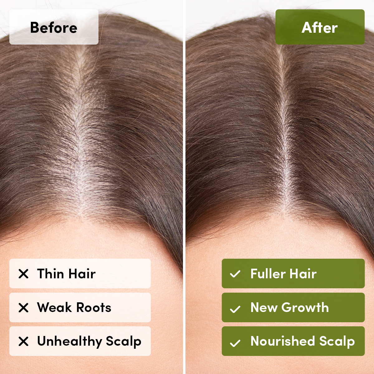Rosemary Scalp & Hair Mist